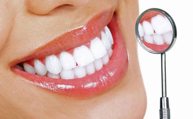 Chi phí bọc răng sứ thẩm mỹ giá bao nhiêu?