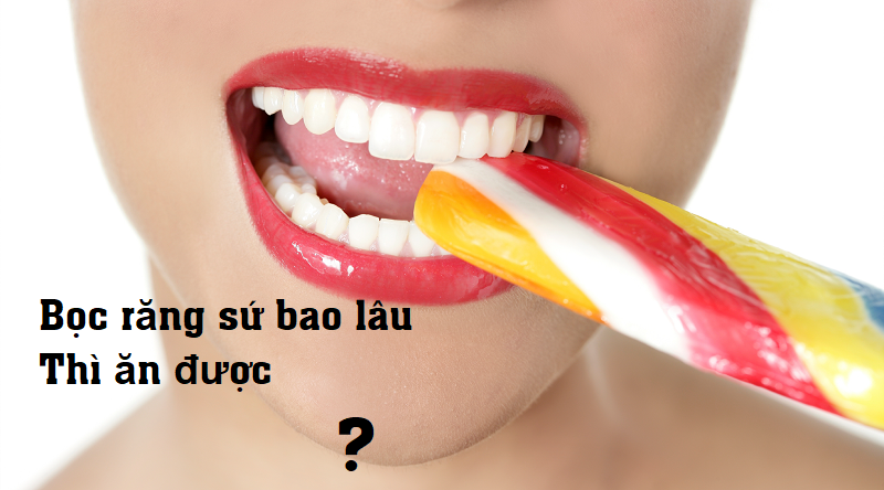 Bọc răng sứ bao lâu thì ăn được? Cách chăm sóc sau khi bọc