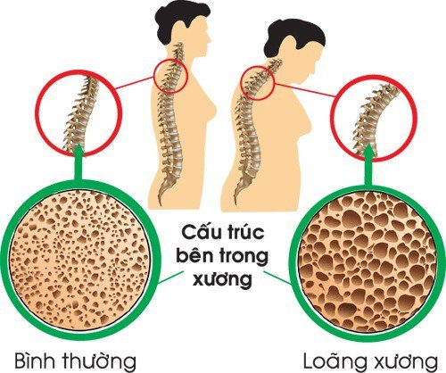 Răng Lung Lay Có Nên Nhổ Không? Những Vấn Đề Quan Trọng Bạn Nên Biết - ảnh 4