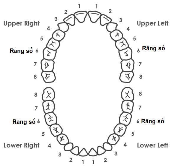 Trồng Răng Hàm Số 6 Bị Mất Bằng Phương Pháp Nào Hiệu Quả Nhất? - ảnh 2