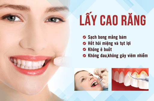 Lấy Cao Răng Giá Bao Nhiêu? Cập Nhật Bảng Giá Chuẩn Năm 2021 - ảnh 3