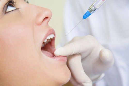 Lấy Tủy Răng Có Đau Không? Khi Nào Nên Lấy Tủy Răng? Nha Khoa Quốc Tế Á Châu - ảnh 6