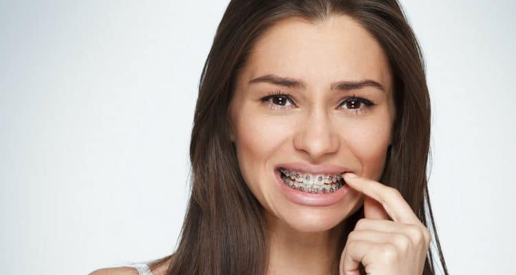 Mang Thai Có Niềng Răng Được Không? – Nha Khoa Quốc Tế Á Châu - ảnh 3