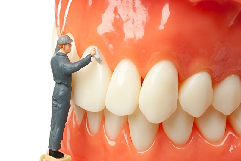 Lấy Cao Răng Có Làm Hỏng Men Răng Không? – Nha Khoa Quốc Tế Á Châu - ảnh 1