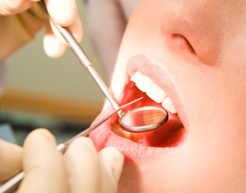 Lấy Cao Răng Có Làm Hỏng Men Răng Không? – Nha Khoa Quốc Tế Á Châu - ảnh 8