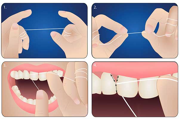 Chỉnh Răng Không Cần Niềng Được Không? – Nha Khoa Quốc Tế Á Châu - ảnh 5