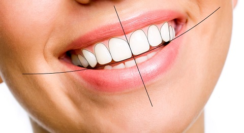  5 tiêu chuẩn hàm răng đẹp tự nhiên các bạn cần phải biết 