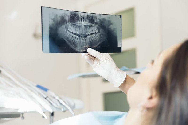 Lý Do Cần Chụp X-Quang Trước Khi Niềng Răng? – Nha Khoa Quốc Tế Á Châu - ảnh 3