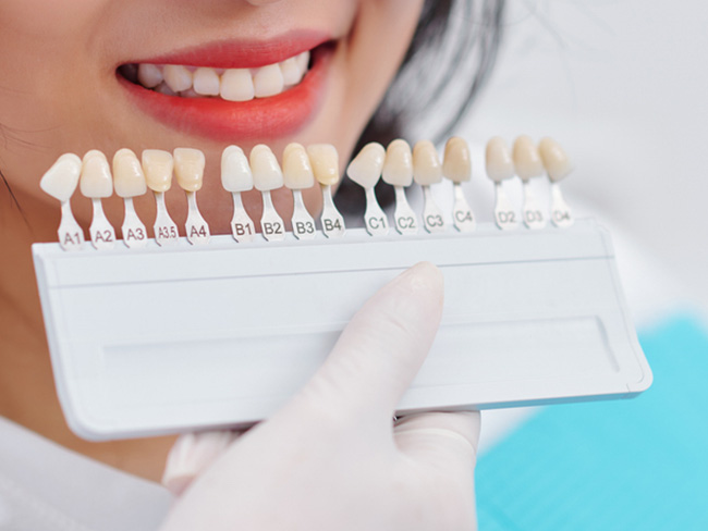 Bọc Răng Sứ Có Bị Sâu Răng Không? – Nha Khoa Quốc Tế Á Châu - ảnh 6