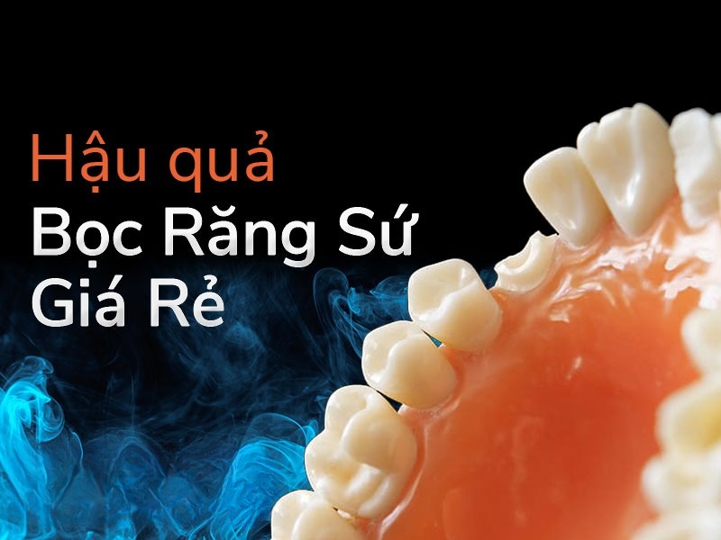 Hối Hận Khi Làm Răng Sứ Giá Rẻ - [Cảnh Báo Biến Chứng] - ảnh 2