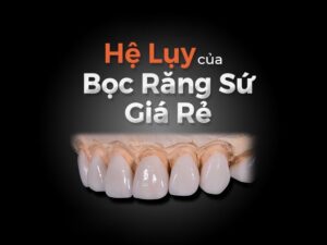 Hối Hận Khi Làm Răng Sứ Giá Rẻ - [Cảnh Báo Biến Chứng]