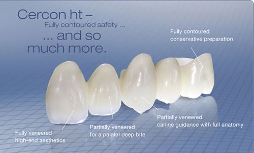 Răng Sứ Loại Nào Cứng Nhất? Bền & Tốt Nhất Thị Trường? - ảnh 9