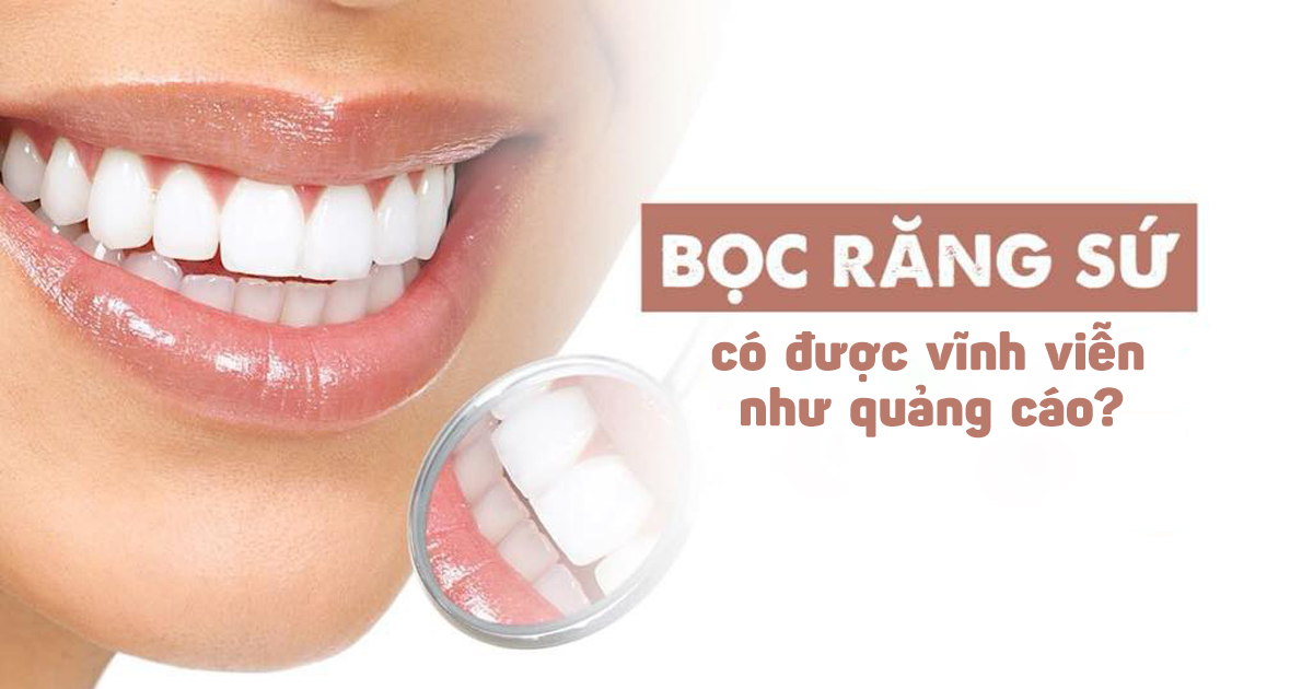 Giải Đáp Thắc Mắc: Răng Sứ Có Được Bảo Hành Vĩnh Viễn? - ảnh 4