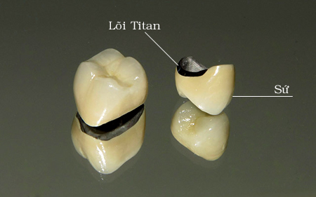 Răng Sứ Loại Nào Cứng Nhất? Bền & Tốt Nhất Thị Trường? - ảnh 3