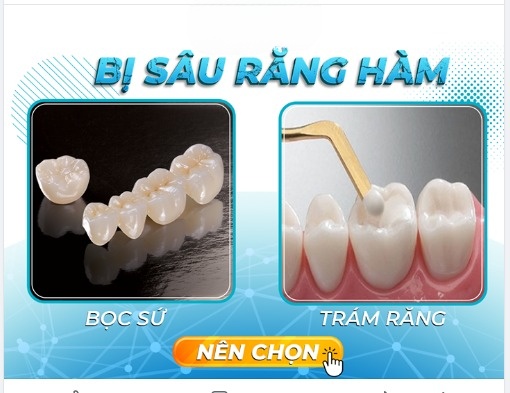 Bọc Răng Số 5 Có Tốt Không? Giá Bao Nhiêu? - ảnh 6