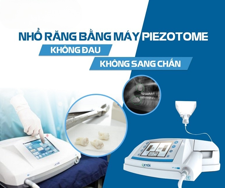 Nhổ Răng Khôn 500K An Toàn - Không Đau – Hồi Phục Nhanh - ảnh 5