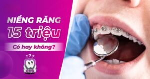 Có Niềng Răng 15 Triệu Hay Không? – Nha Khoa Quốc Tế Á Châu