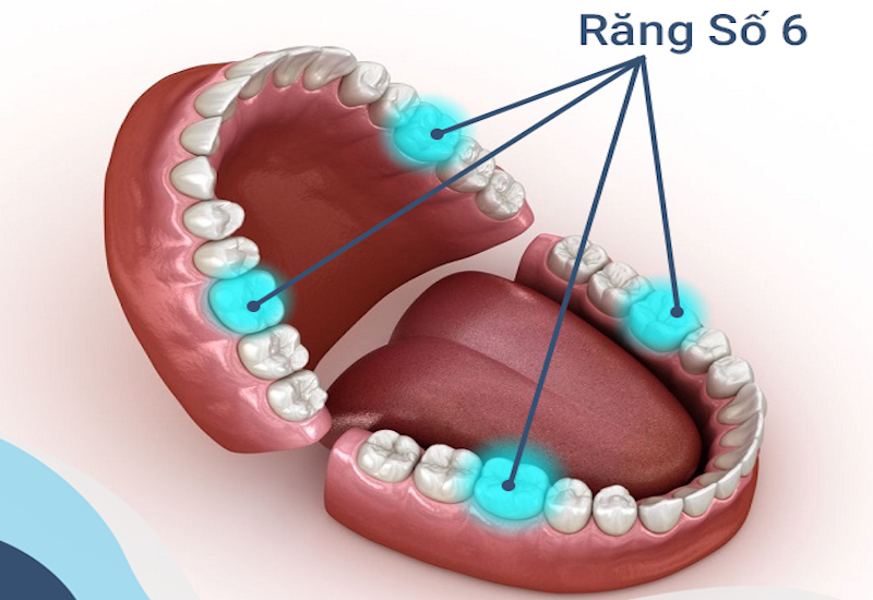 Bọc Răng Số 6 Có Tốt Không? Giá Bao Nhiêu? - ảnh 2