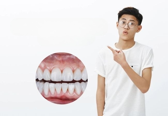Bọc răng sứ có thể sử dụng cho mọi loại vấn đề răng miệng của trẻ em 15 tuổi không?
