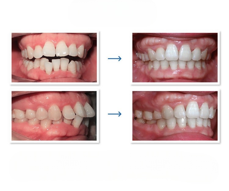 Nha Khoa Giá Rẻ Hà Nội, Chi Phí Tiết Kiệm Chất Lượng Đảm Bảo - ảnh 16