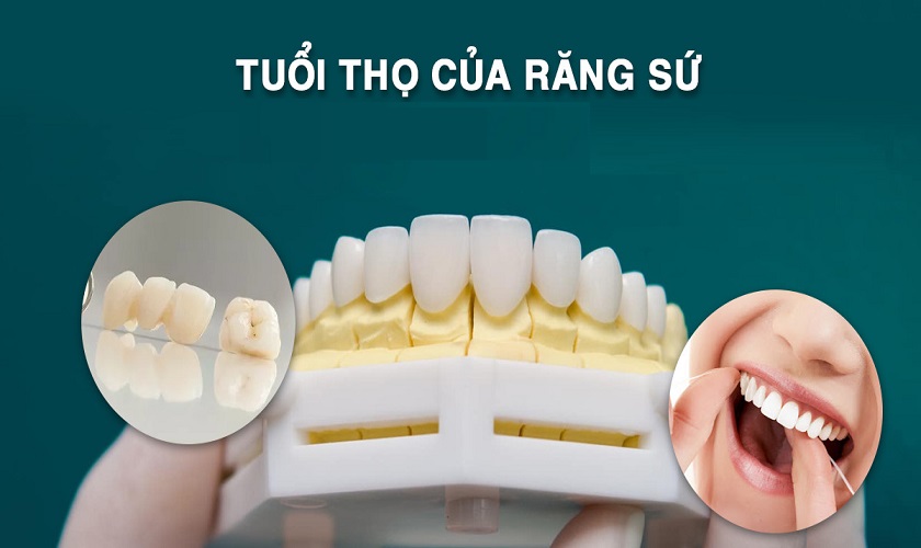 41 42 43 Tuổi Có Bọc Răng Sứ Được Không? Giá Bao Nhiêu? - ảnh 5