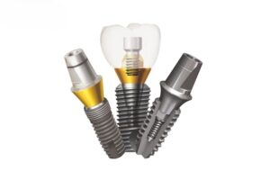 Giá Trụ Implant Mỹ - Bảng Giá & Chi Phí Trụ Implant Mỹ