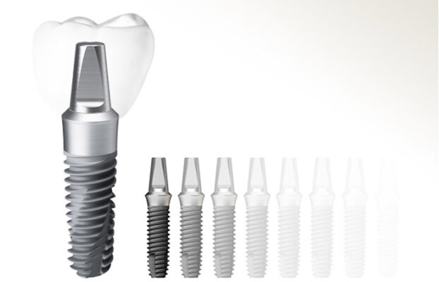 Giá Trụ Implant Mỹ - ảnh 6