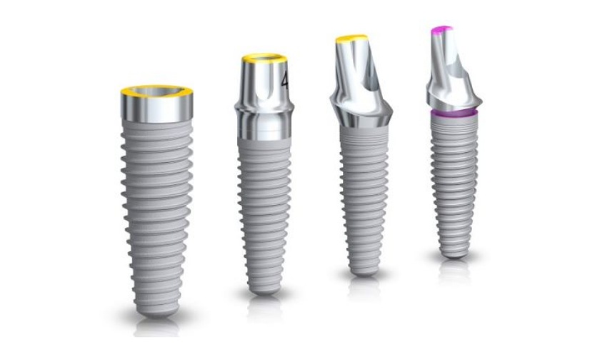 Giá Trụ Implant Mỹ - ảnh 9