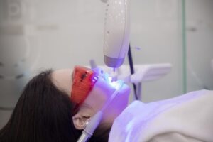 Tẩy Trắng Răng Bằng Laser Có Nên Không?