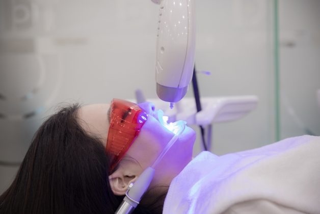 Tẩy Trắng Răng Bằng Laser Có Nên Không? 