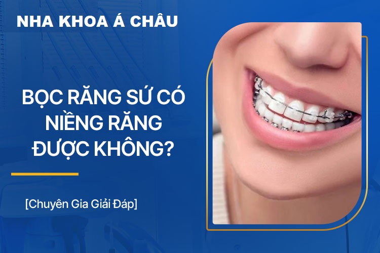 Bọc răng sứ có niềng được không?