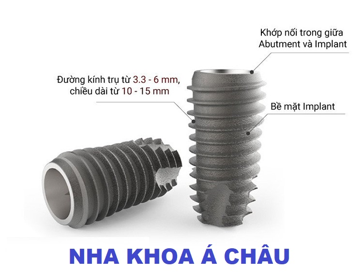 Trụ Implant DIO Hàn Quốc có tốt không?