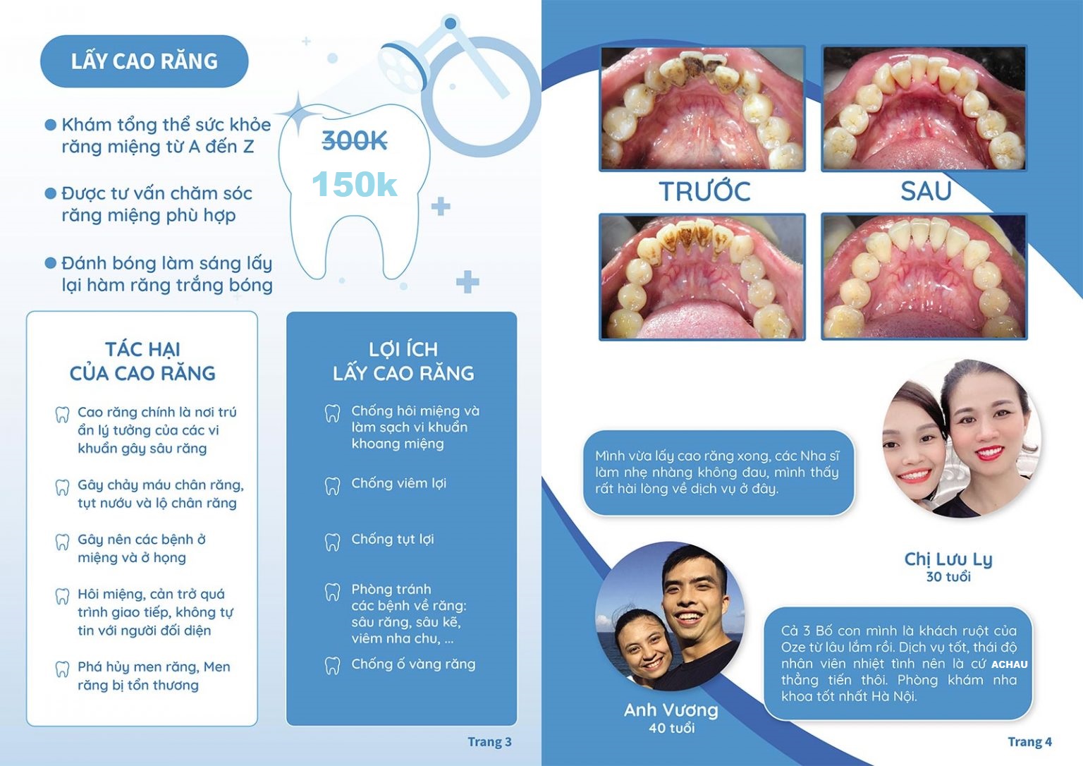 7+ Điều cần biết cho người chưa bao giờ lấy cao răng