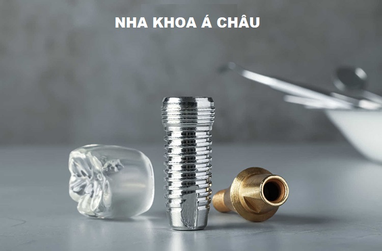 Cấu Tạo Trụ Implant? Cách chọn trụ Implant phù hợp