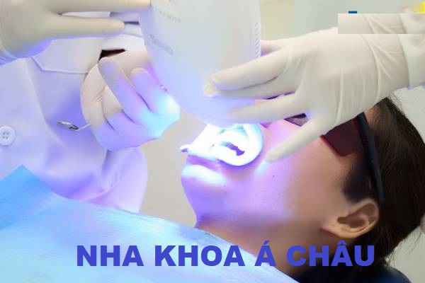 Kinh nghiệm tẩy trắng răng – Chia sẻ 6 phương pháp phổ biến 7