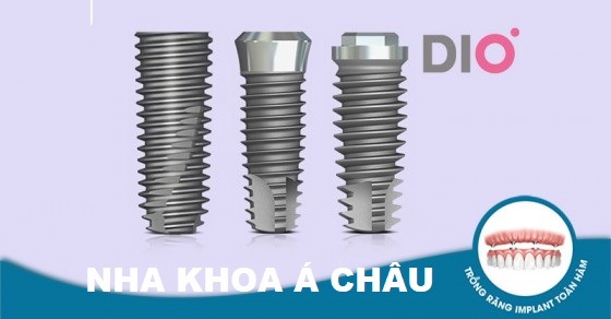 Trụ Implant DIO Hàn Quốc có tốt không? Ảnh 1