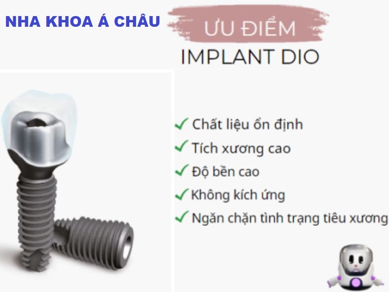 Trụ Implant DIO Hàn Quốc có tốt không?